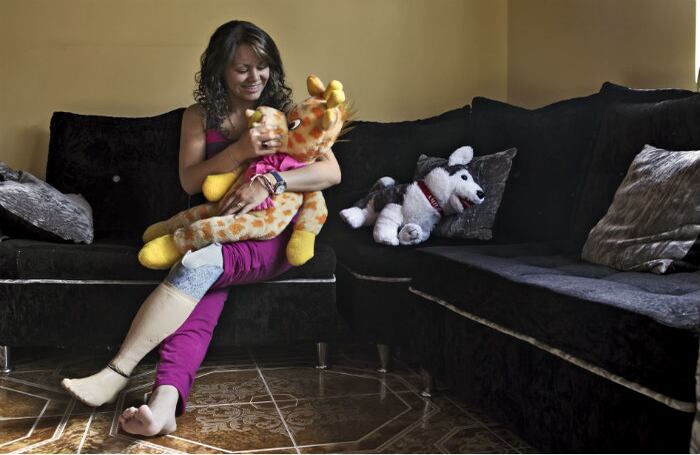 LICETH: El 14 de Junio del 2002, el sonido de un avión hizo que Liceth Noche, entonces de 10 años de edad, saliera de su casa de la vereda El Palmón, en el municipio de Ciénaga, Magdalena, en compañia de sus hermanos Édinson, de 14, y Jeison, de 12. Cuando se encontraban observando el cielo, varias explosiones cubrieron de tierra todo alrededor y Liceth terminó gravemente herida en las piernas. Su madre, que se encontraba cerca, acudió en su ayuda y en medio del caos y el miedo corrió bajo la vegetación con la niña en sus brazos hasta una finca vecina. Liceth perdió a dos de sus hermanos, la pierna izquierda y la movilidad de la derecha. Días después, la fuerza aérea reconocería que había cometido un error al bombardear equivocadamente la finca de la familia Noche. Semanas después y mientras se recuperaba en Bogotá junto con su madre, decidió no volver nunca más al lugar del ataque. Su padre vendió la tierra y se instalaron en la capital. Diez años después, Liceth cursa primer semestre de enfermería, carrera que escogió en medio de sus múltiples visitas a los centros de salud. Como profesional, dice, podrá ayudar a quien lo necesite.