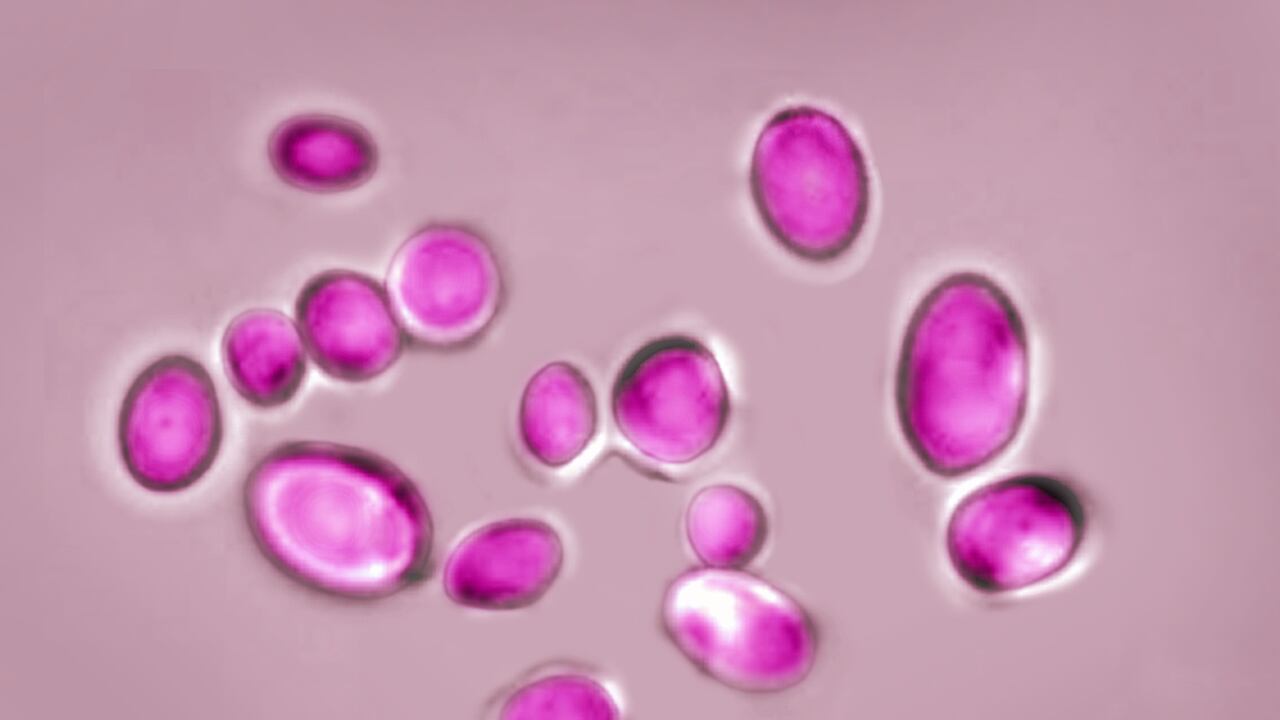 Candida auris is a yeast responsible for many infections. Resistant to most antifungal drugs, this fungus causes several deaths worldwide. Optical microscope view. (Photo by: BSIP/Education Images/Universal Images Group via Getty Images)