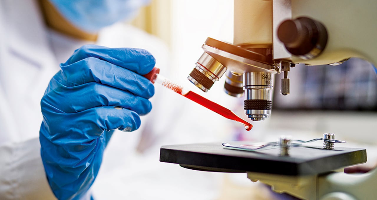 En Colombia, los casos de VIH vienen aumentando cada año. Mientras que en 2012 se presentaron 5.275, en 2023 esta cifra casi se triplicó hasta los 14.670 nuevos reportes.