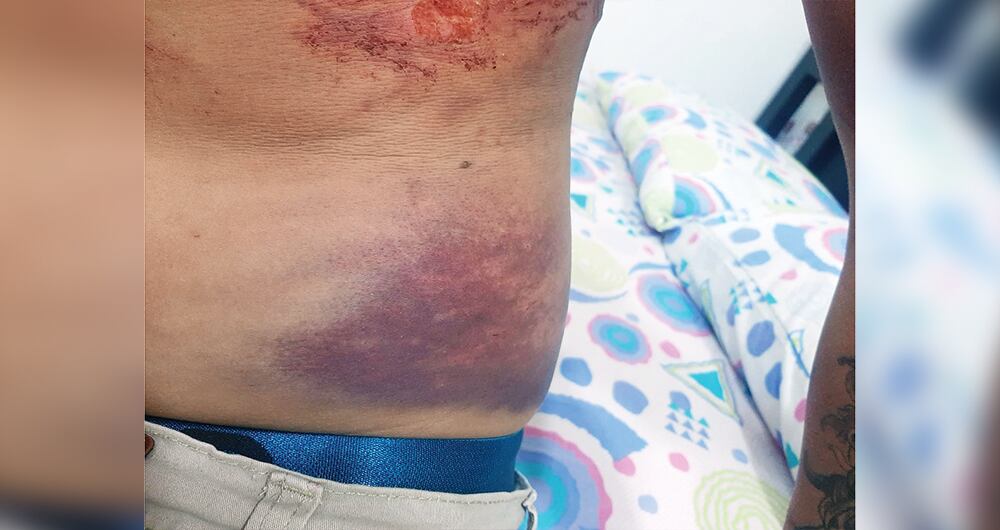 El 24 de abril, al finalizar la tarde, llegó a la Fiscalía de la capital antioqueña. Durante horas se sentó con los investigadores para presentar la denuncia por los delitos de tortura y lesiones dolosas contra 13 uniformados, a los cuales, incluso, señaló con nombre propio.