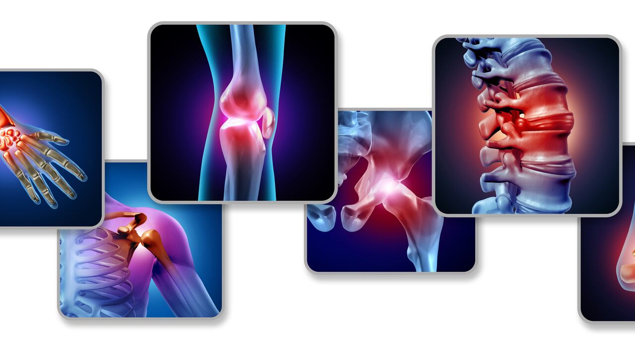 El lupus, por sus complejas derivaciones, causa la muerte a cerca del 90 por ciento de quienes la padecen.