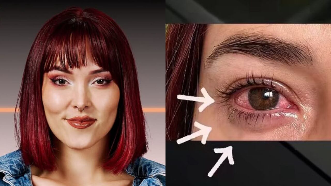 La creadora de contenido destapó el el nombre de la infección con la que fue diagnosticada.