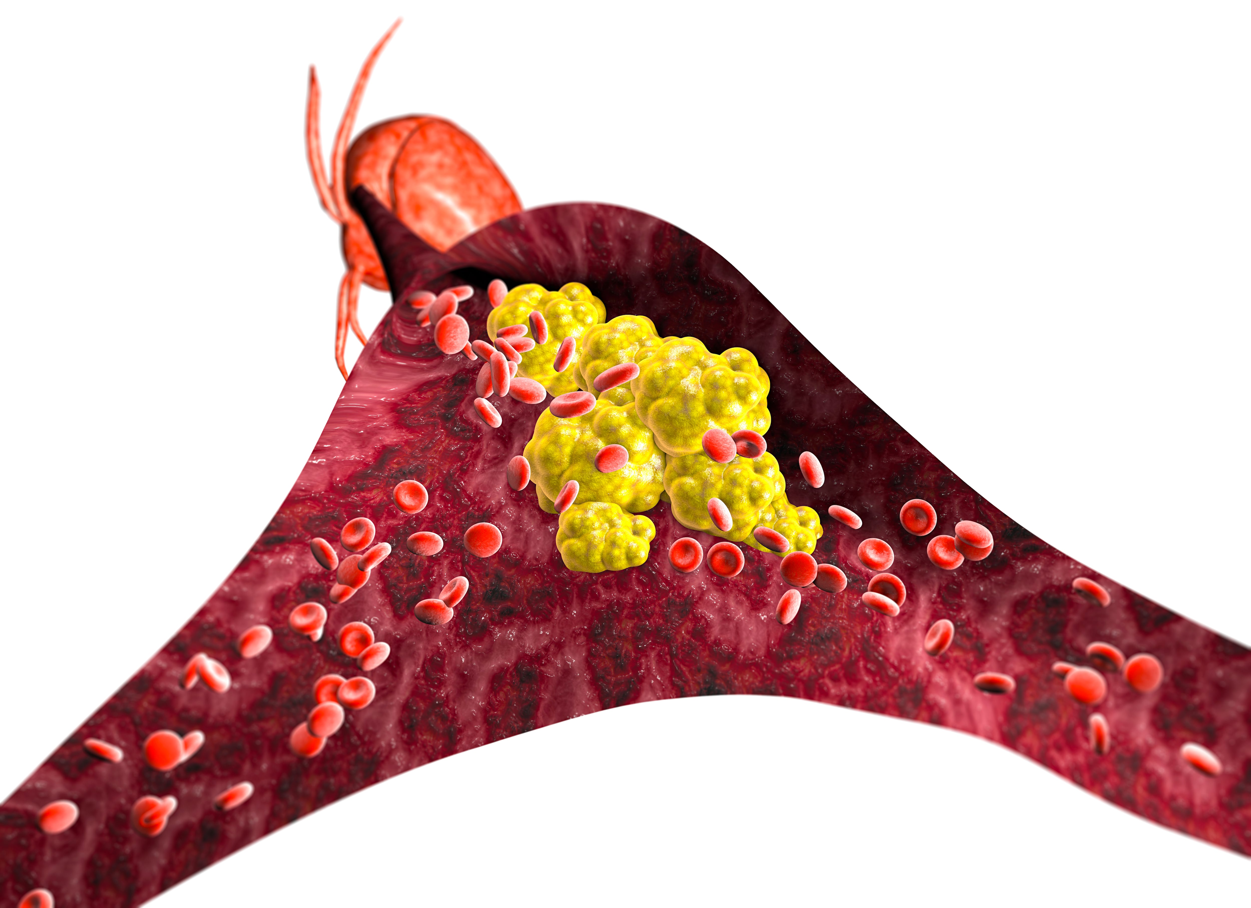 Triglicéridos / Colesterol