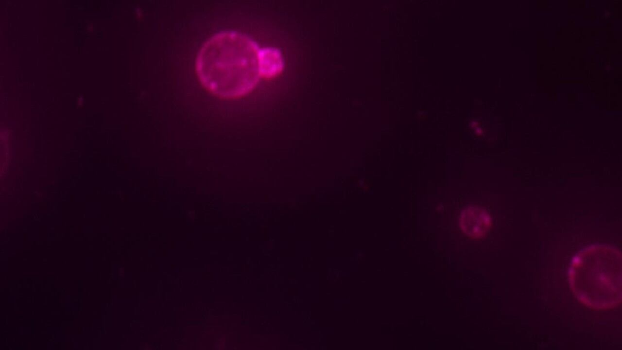 Imagen de la célula sintética con su sistema de traducción y enzimas metabólicas activas, con la membrana teñida de rojo mediante un colorante lipídico.