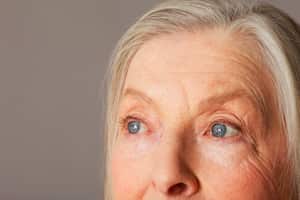 Las arrugas se pueden dan por el movimiento constante de los músculos del rostro.