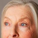 Las arrugas se pueden dan por el movimiento constante de los músculos del rostro.