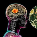 Algunos hongos cerebrales puede causar Alzheimer.