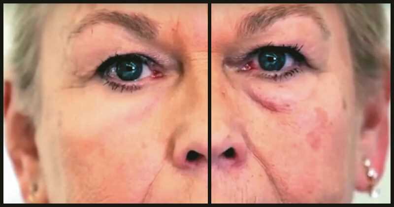 Sería un sueño hecho realidad: que las arrugas y las enfermedades de la vejez desaparezcan.