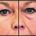 Es un sueño hecho realidad aplicarse una crema y que las arrugas y bolsas de los ojos desaparezcan en cuestión de segundos.