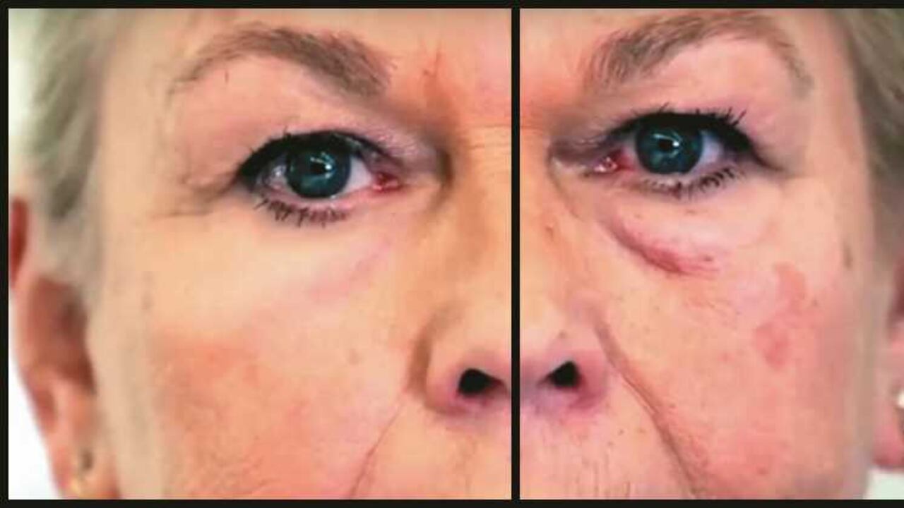 Las ojeras aparecen por diversas razones.