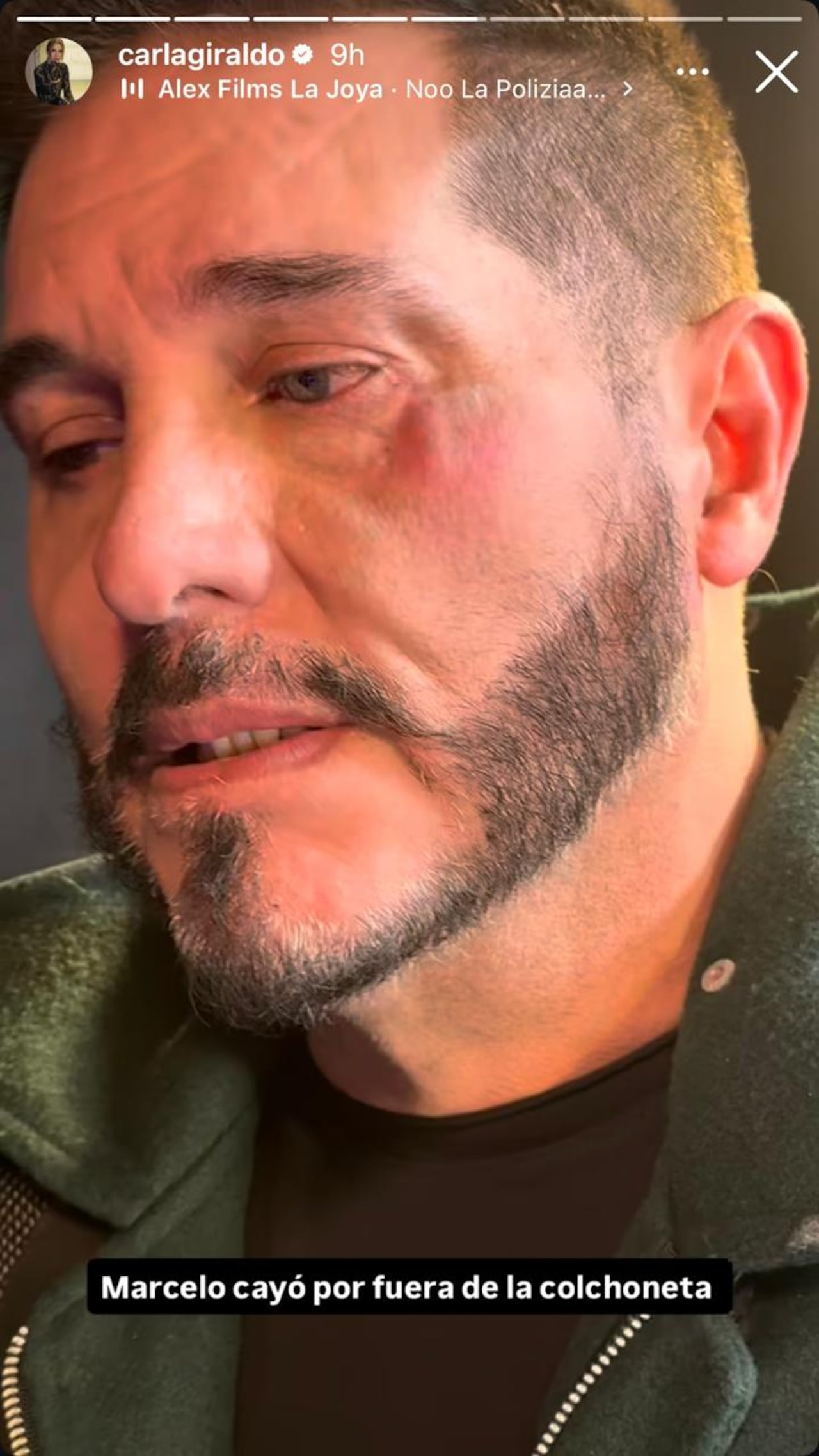 Marcelo Cezán sufrió fuerte caída en las grabaciones de 'La casa de los famosos'.