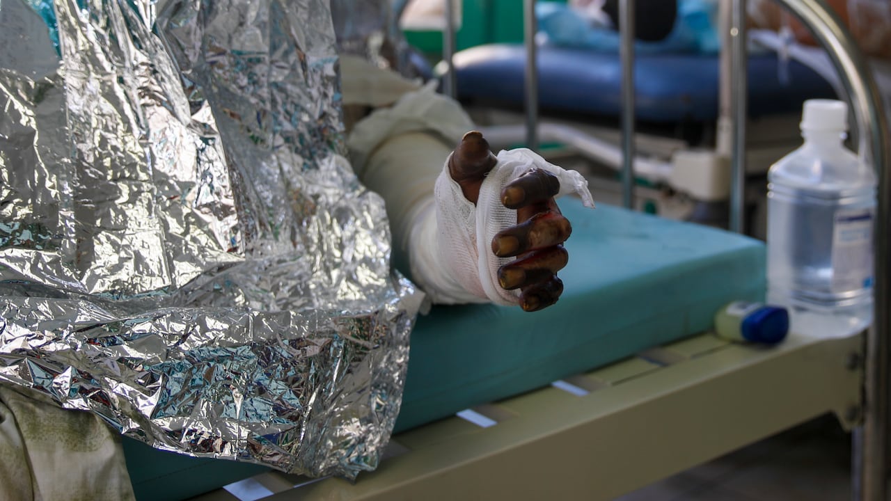 A 62 suben los muertos por explosión de camión cisterna en Haití