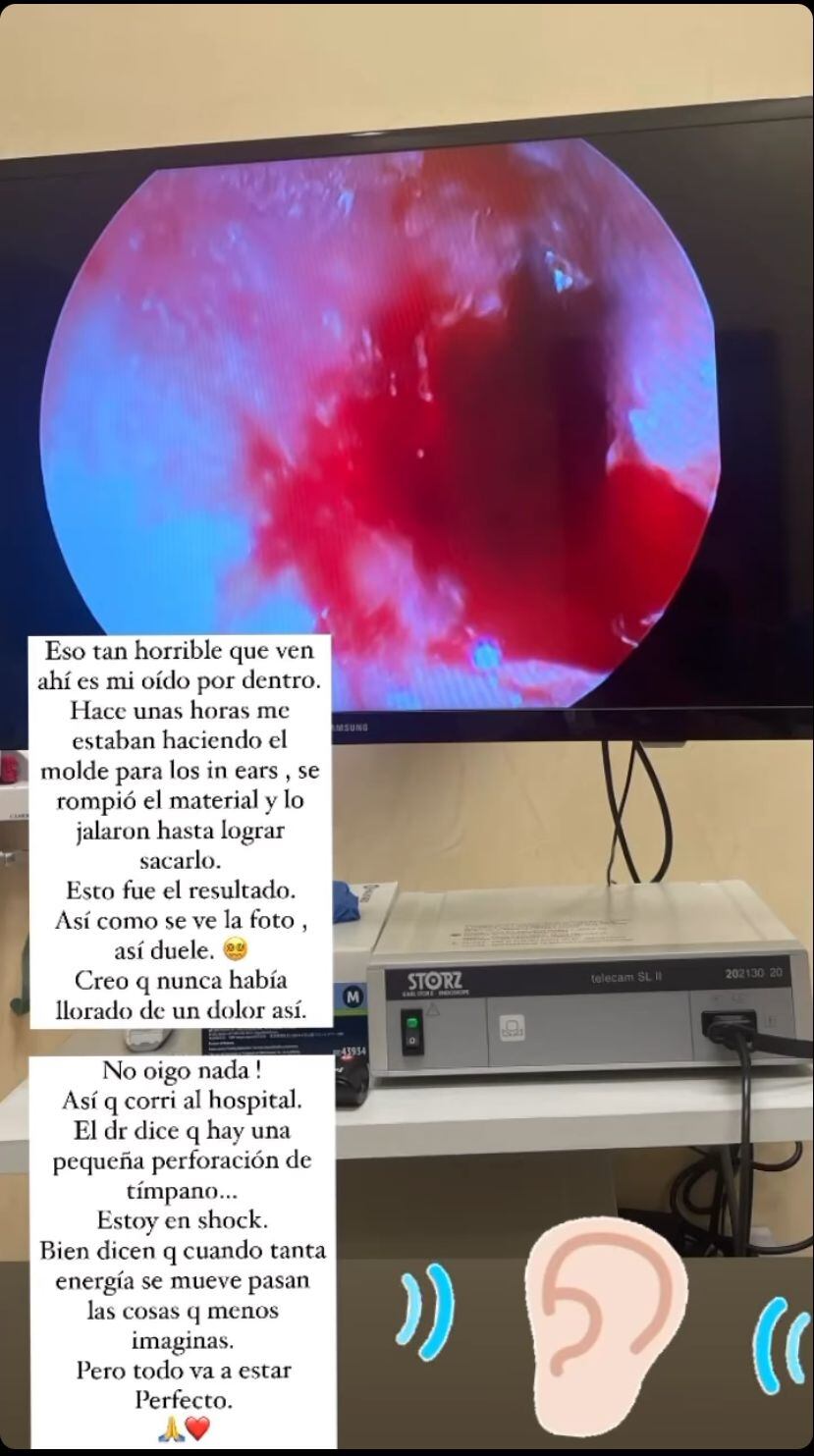 La cantante explicó lo que sucedió.