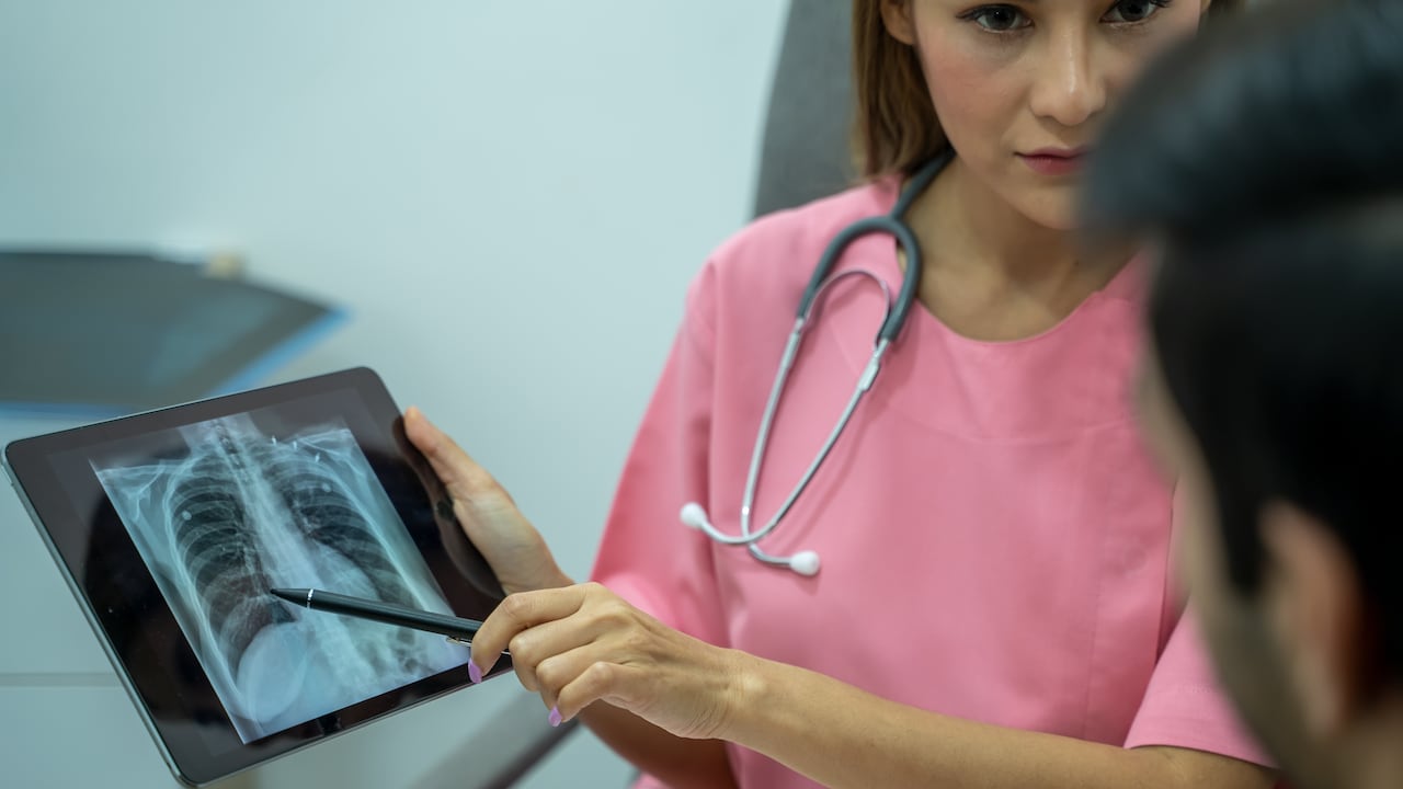 La tuberculosis contagiosa se puede transmitir cuando una persona con TB activa tose, estornuda o habla