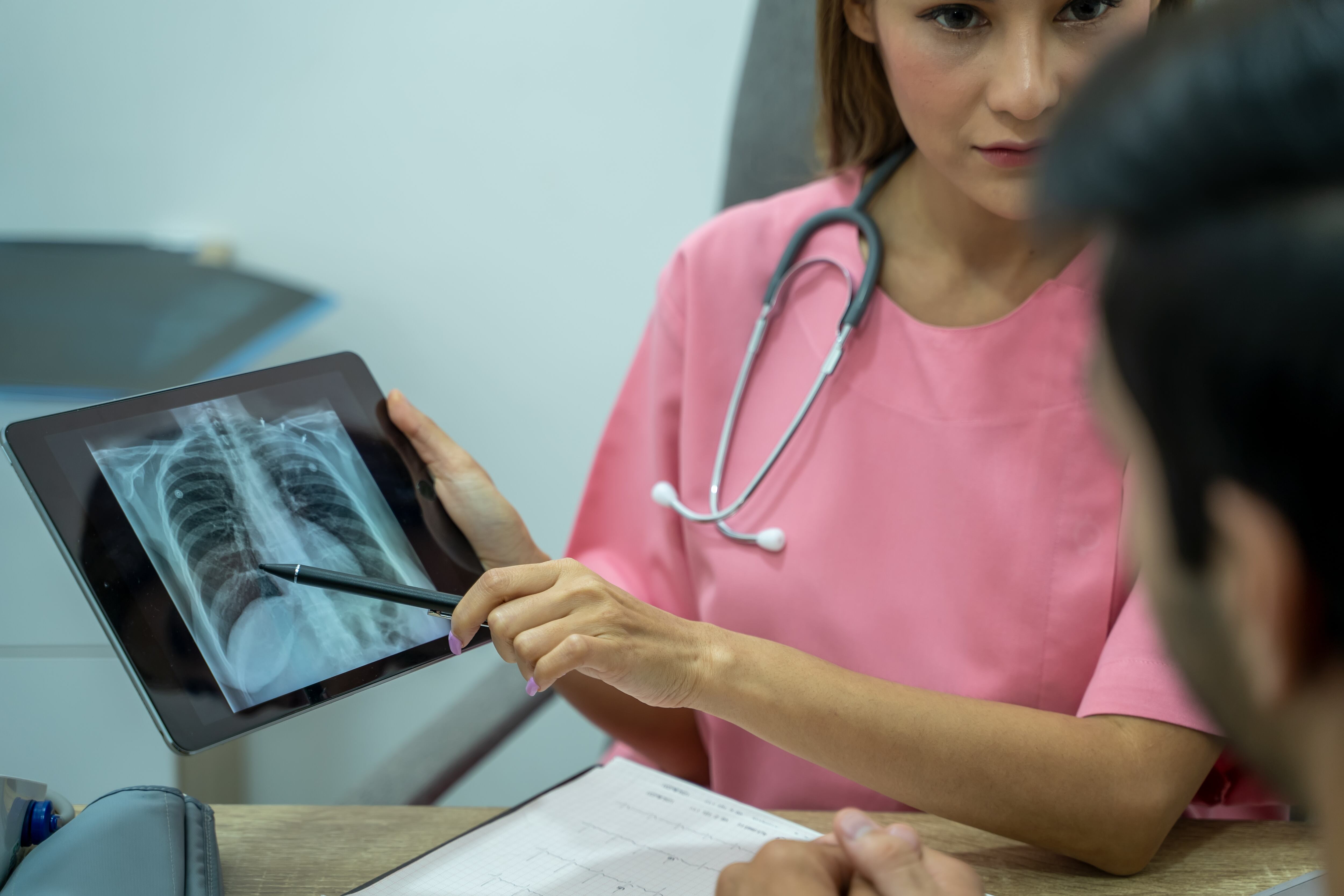 La tuberculosis contagiosa se puede transmitir cuando una persona con TB activa tose, estornuda o habla