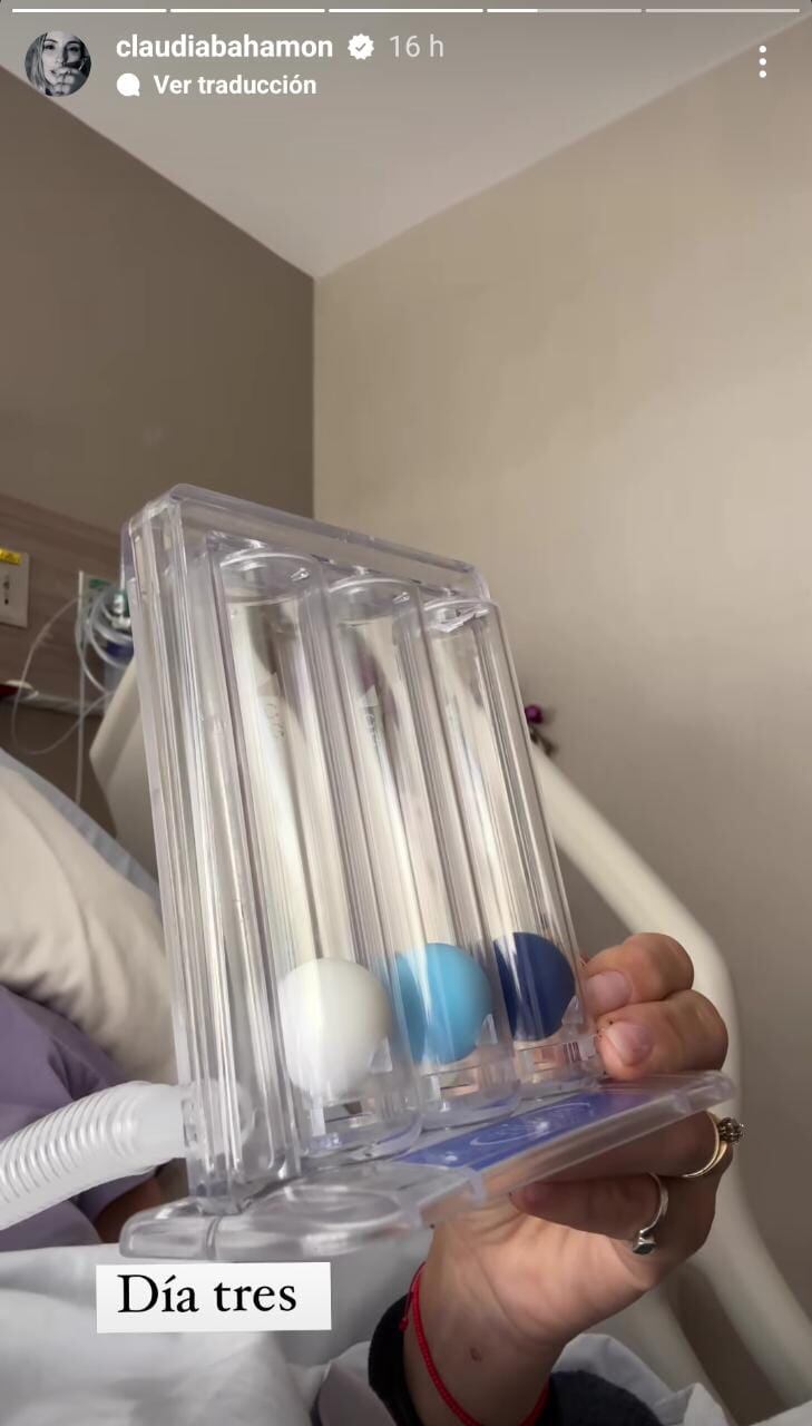 Durante los primeros tres días, posteriores a la cirugía de Claudia Bahamón, el resultado en sus terapias era mínimo.