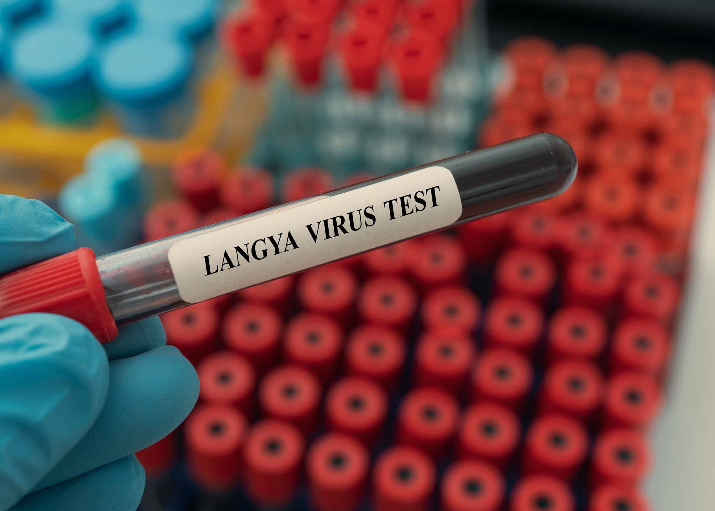 Virus Langya