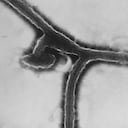 Vista microscópica del virus de Marburgo.