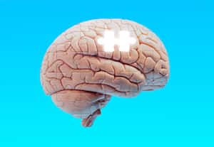 Foto de referencia sobre alzhéimer