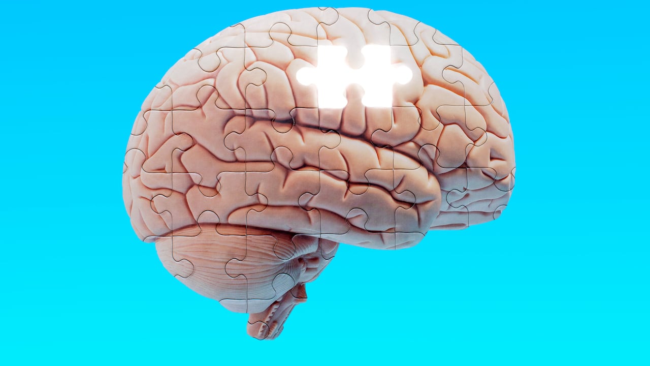 Foto de referencia sobre alzhéimer