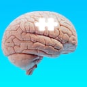 Foto de referencia sobre alzhéimer