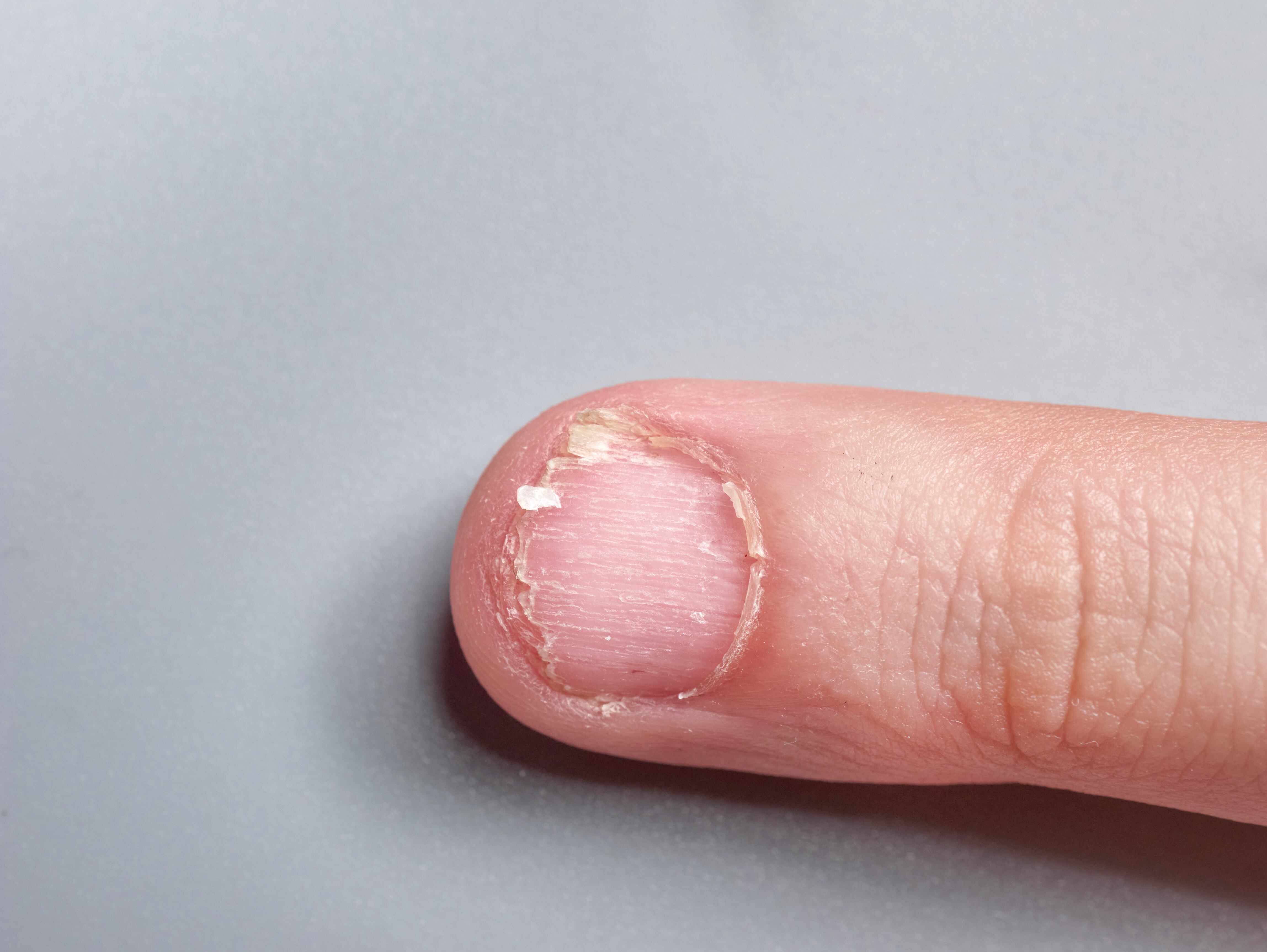 El calcio es un mineral importante para el cuerpo.