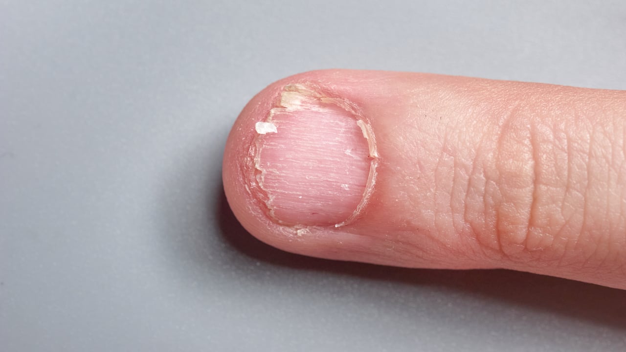 El calcio es un mineral importante para el cuerpo.