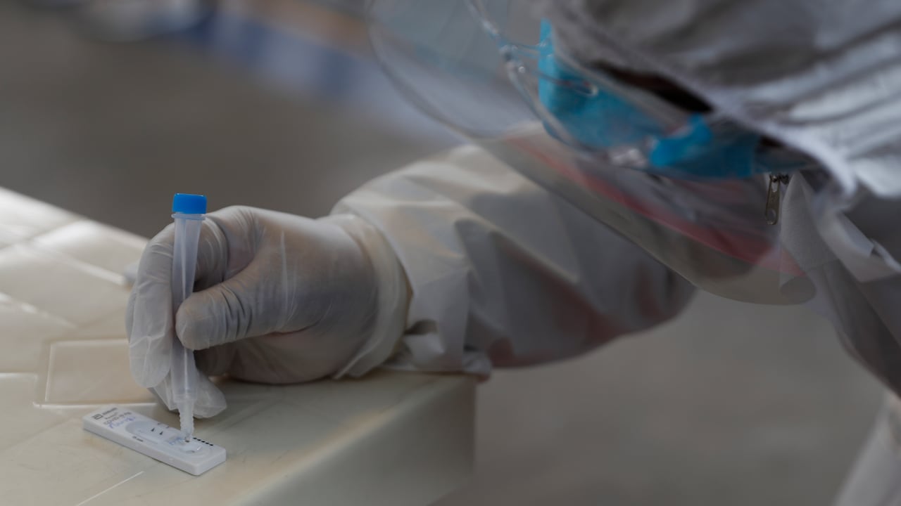 (AP Photo/Juan Karita)