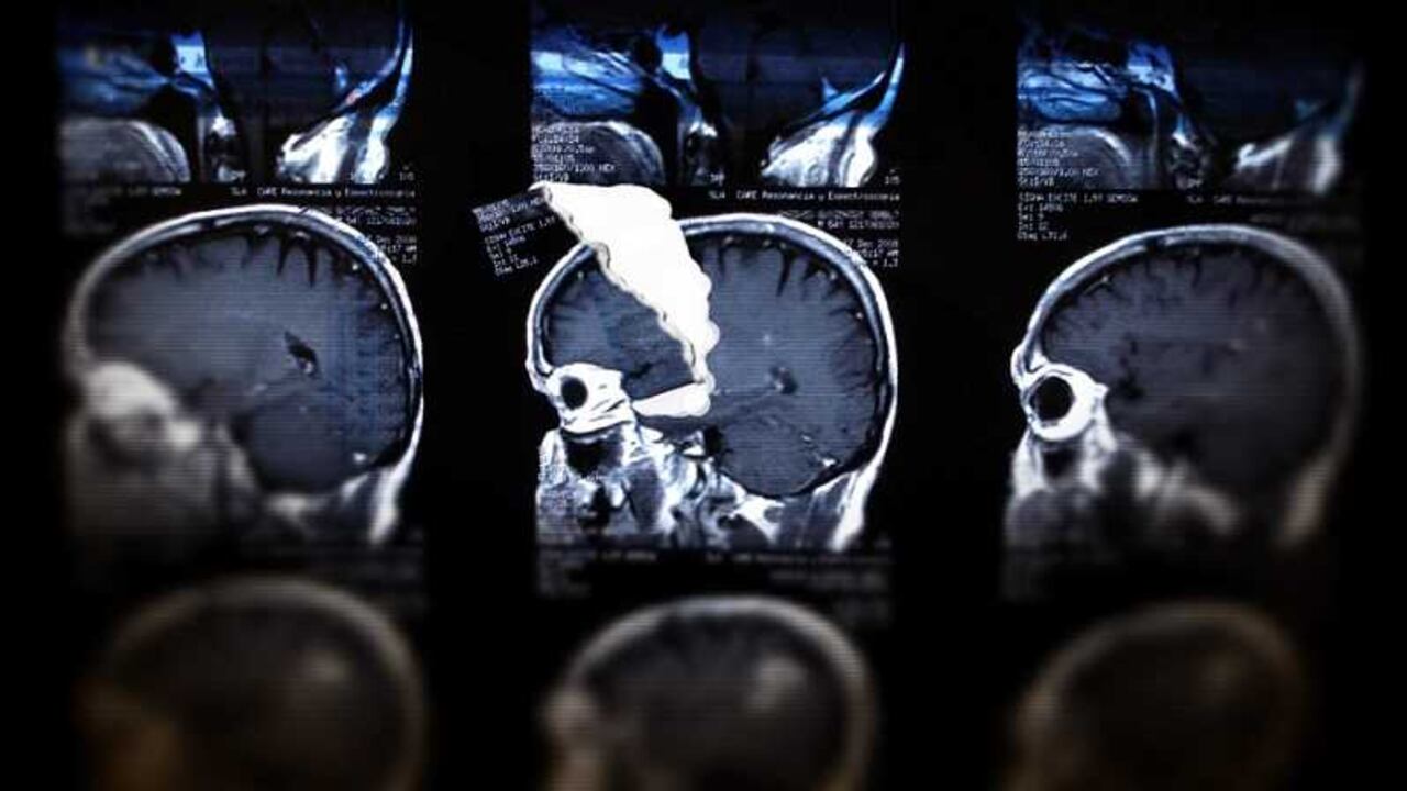 La neuroeconomía analiza cómo el cerebro reacciona ante la toma de decisiones de compras e inversiones.