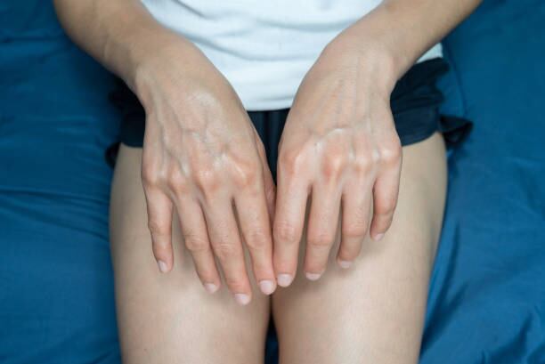 La mala circulación es el resultado directo de varias condiciones diferentes.