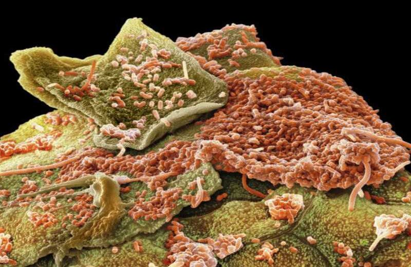 Para distinguir los microbios que se encuentran dentro de las encías, los dientes y en el interior de la mejilla, se utilizaron colorantes artificiales.