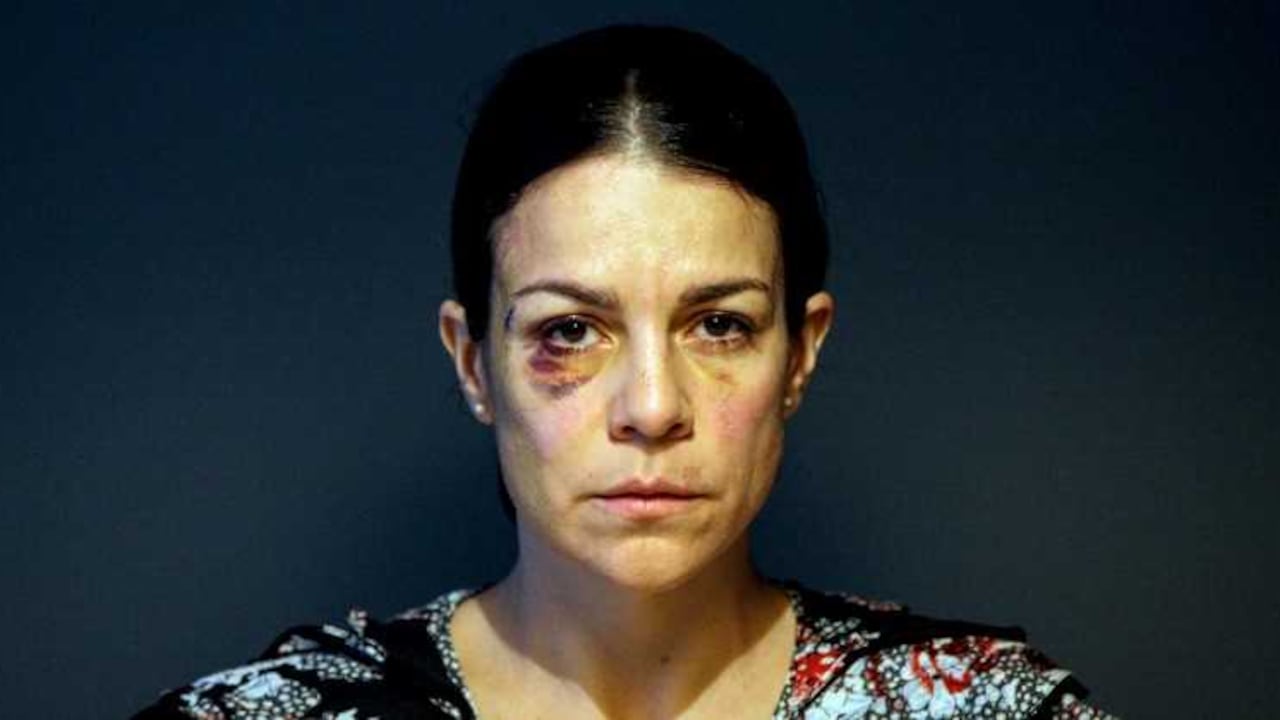 A través de las redes sociales María Isabel Covaleda denunció una brutal golpiza por parte de su exnovio Camilo Sanclemente.