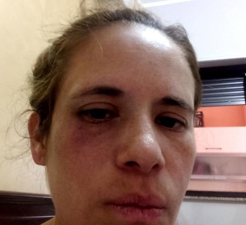 Periodista colombiana denuncia maltrato intrafamiliar