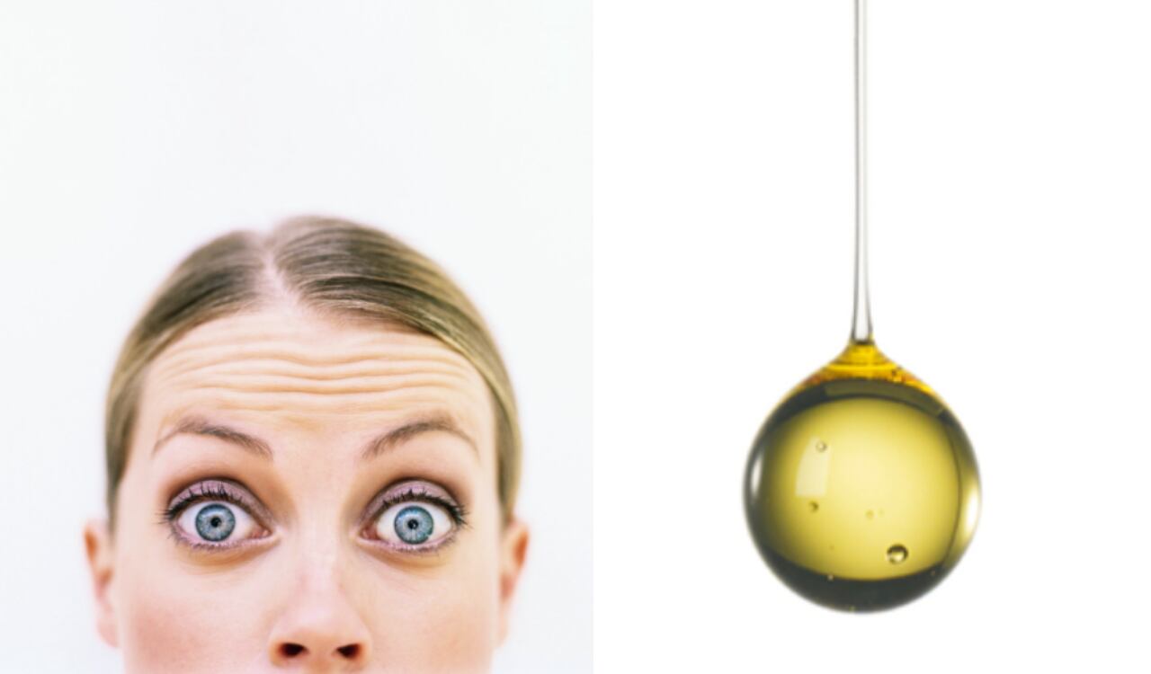 Arrugas, aceite, piel, líneas de expresión