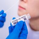 Autoridades en Alemania están preocupadas por las cifras de muertos a causa del coronavirus. Foto: GettyImages.