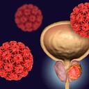 Conceptual image for viral ethiology of prostate cancer. 3D illustration showing Human Papilloma Viruses HPV infecting prostate gland which develops cancerous tumor
