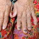 ¿Cómo curar los hongos de las uñas de las manos con remedios caseros?