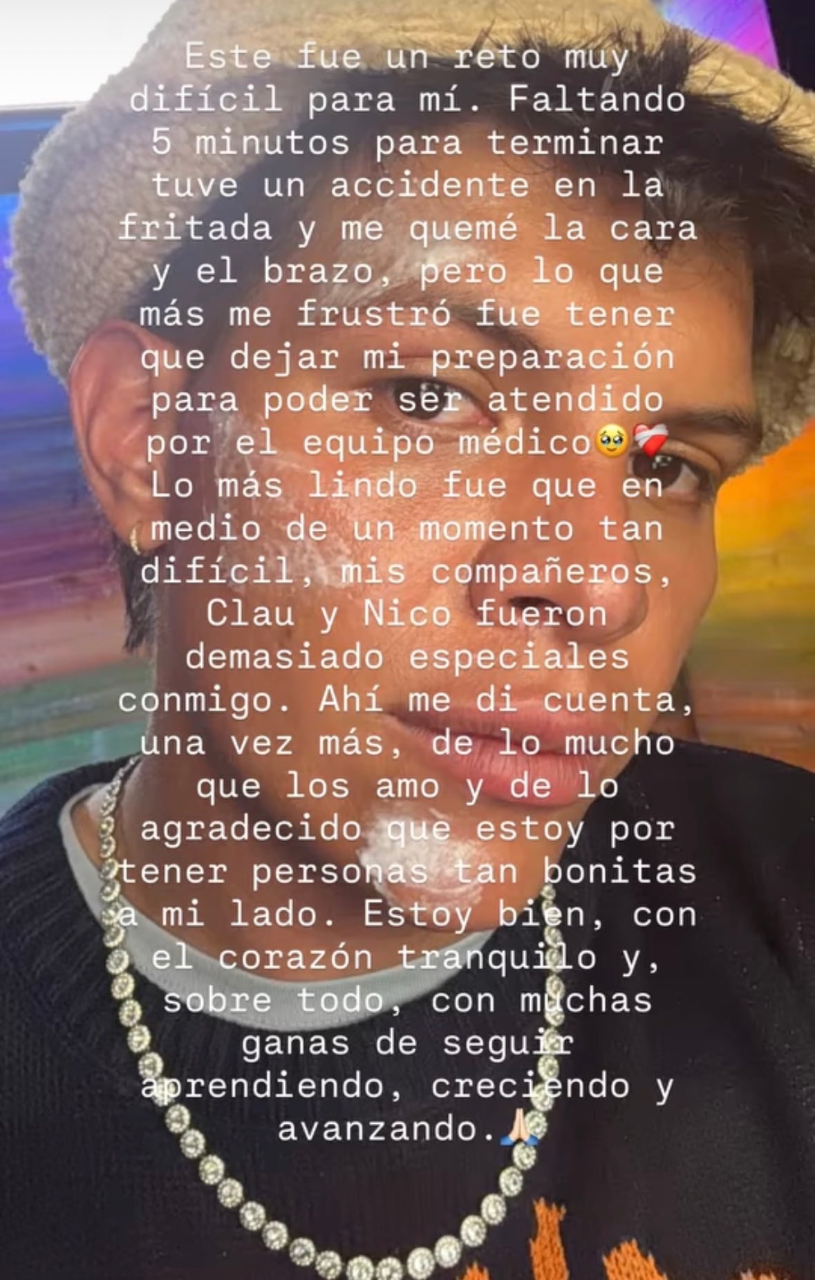 Emiro Navarro se pronunció tras accidente que sufrió en 'MasterChef'.
