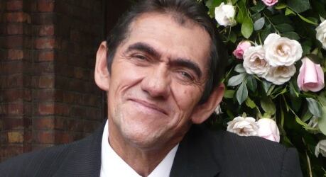 Mandíbula enfermedad