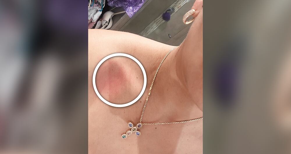     La mujer asegura que el diputado la agredió físicamente en dos ocasiones, por lo que pide celeridad en las investigaciones. El político niega los señalamientos. 