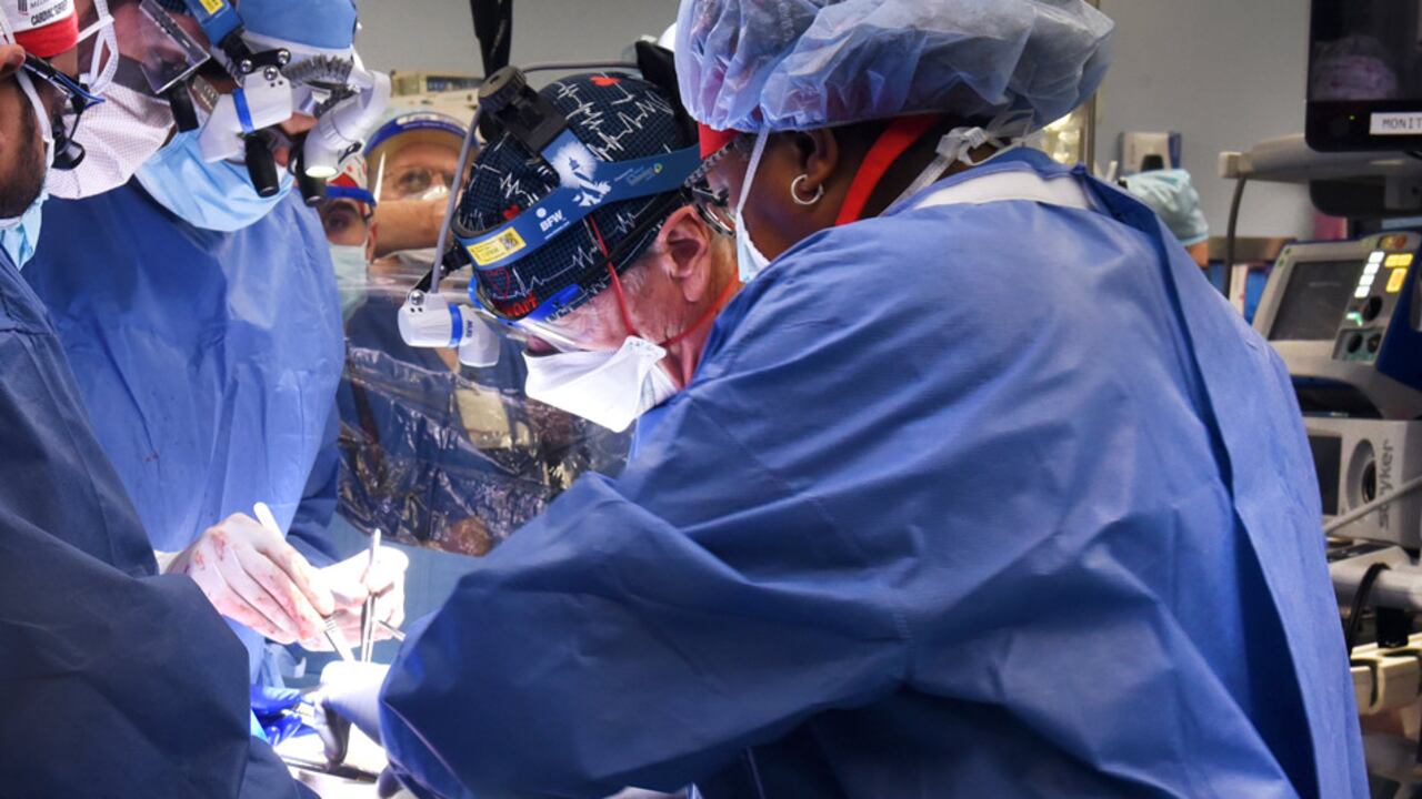 Cirujanos trasplantaron el corazón de un cerdo modificado genéticamente al de un hombre, en Estados Unidos.