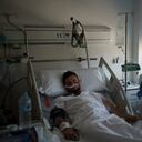 Un paciente con covid-19 recibe tratamiento en UCI. (AP Foto/Felipe Dana)