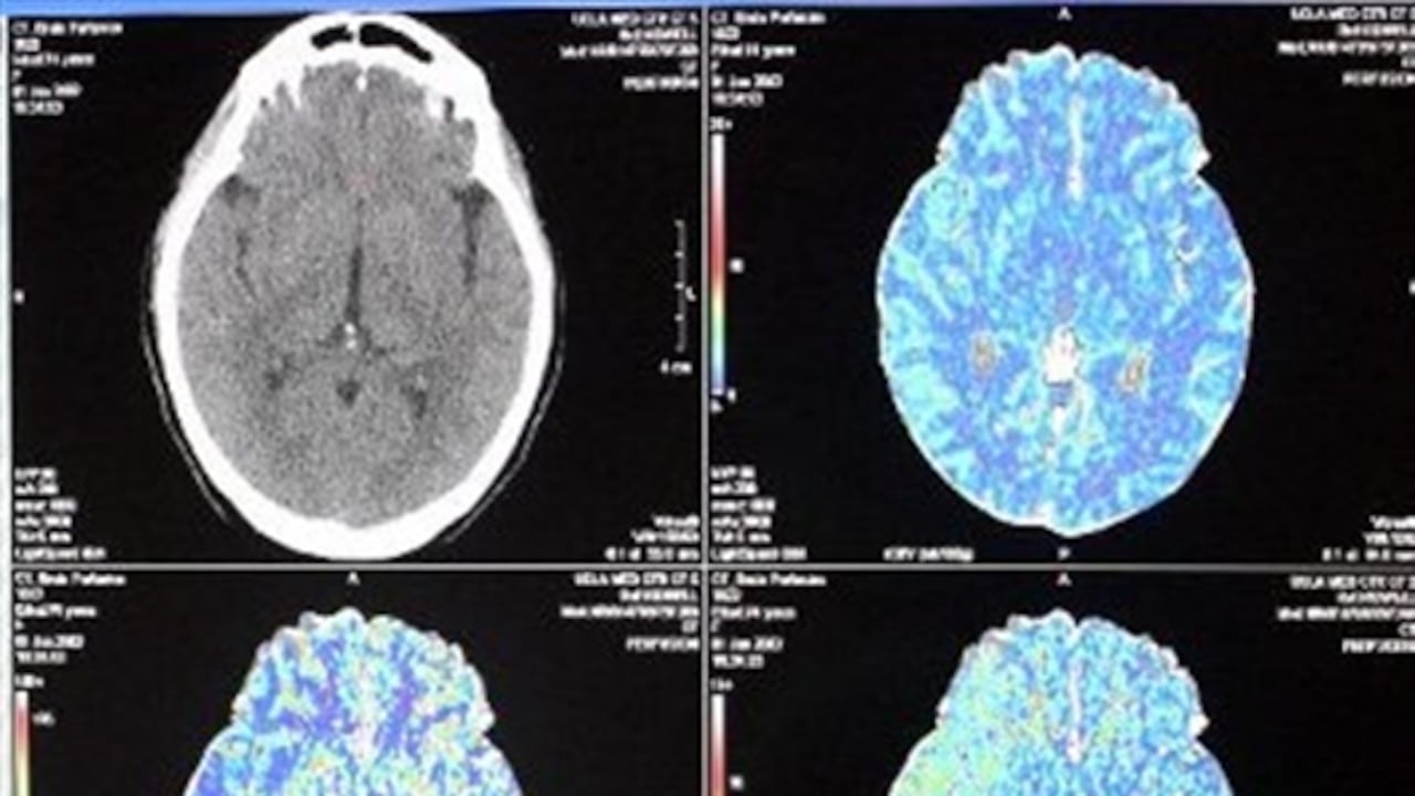 Según un nuevo estudio realizado por neurocientíficos los seres humanos tenemos dos cerebros.