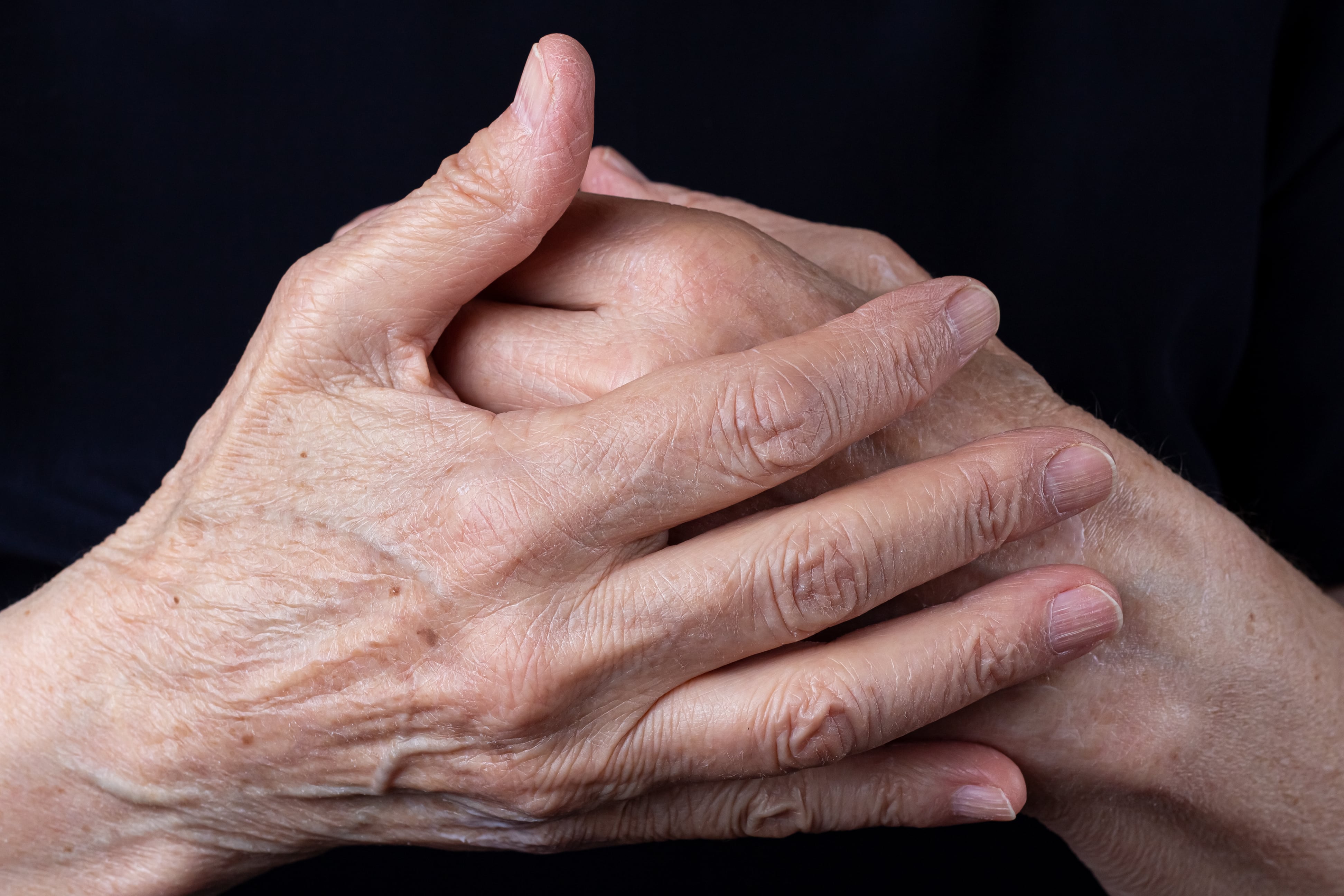 Arrugas en las manos