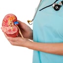 La alimentación es clave para cuidar la salud de los riñones.