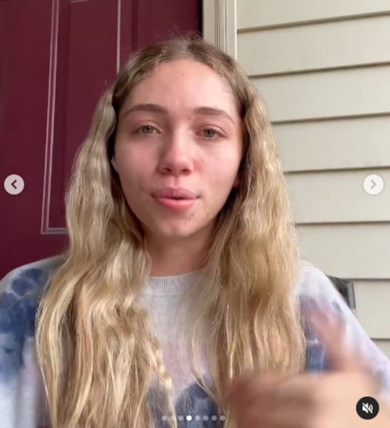 La joven abrió su corazón y contó cómo se siente con el aspecto de su piel