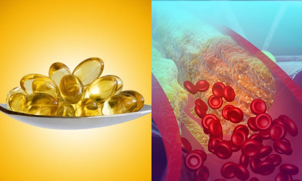 El omega 3 controla el colesterol.