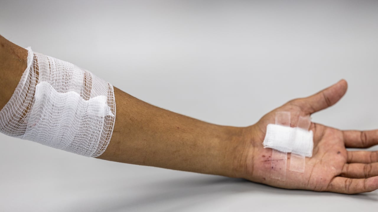 Una investigación plantea que el cuerpo humano podría reconstruir tejidos y no solo formar cicatrices.