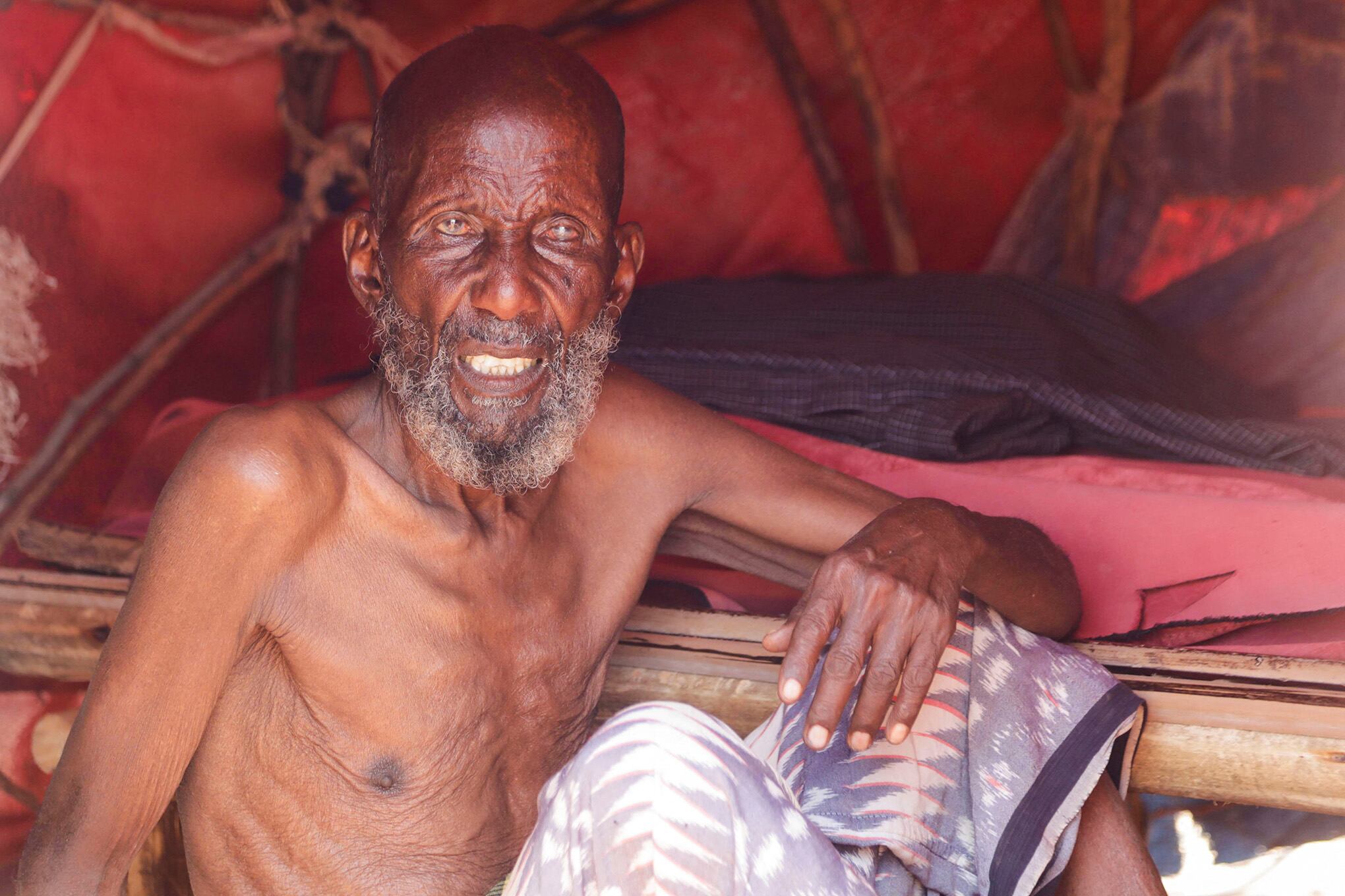 En imágenes : Mientras crece el hambre en Somalia, los bebés comienzan a morir