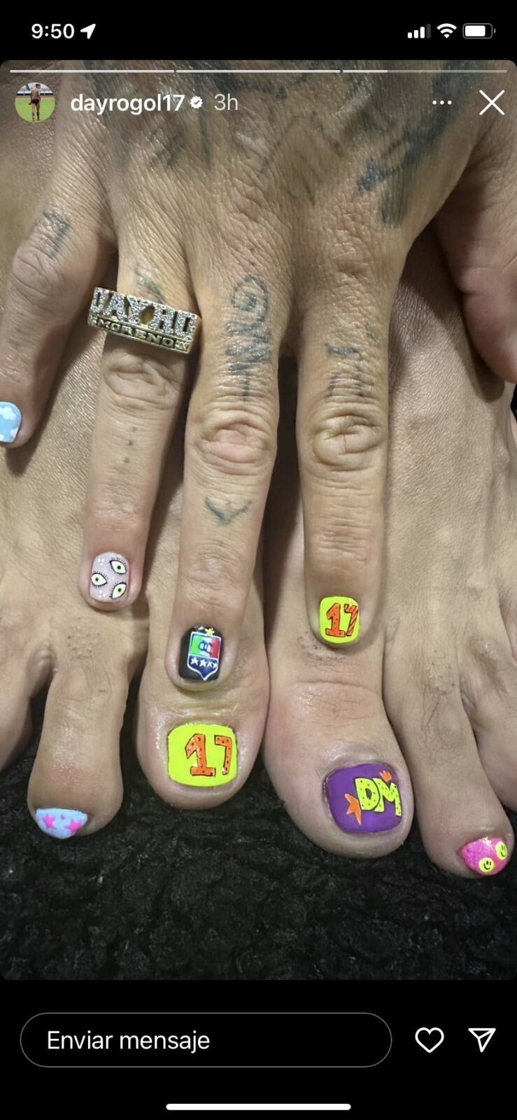 Dayro Moreno y un manicure, pedicure muy colorido